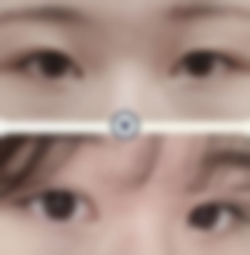 对于医院的发展，我们也可以提出一些建议。比如可以加强对医生的培训和考核，不断提高医生的技术水平和服务质量。还可以加大对设备的更新和维护，确保设备的性能始终处于至佳状态。另外，在宣传方面，可以更加注重患者的真实实例分享，让更多的人了解医院的实力和成效。