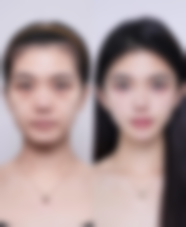 【盘锦兰玉整形医院诊疗设备：】