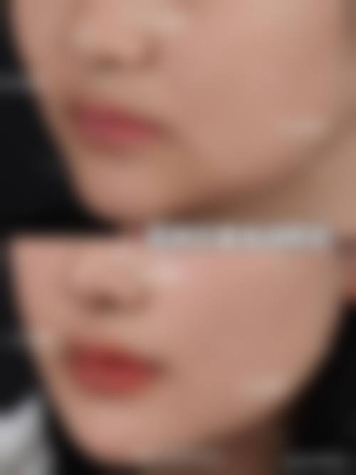 【权纯弘医生技术特点：】