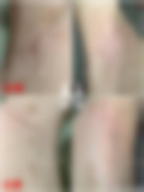 【吕虎医生擅长项目】