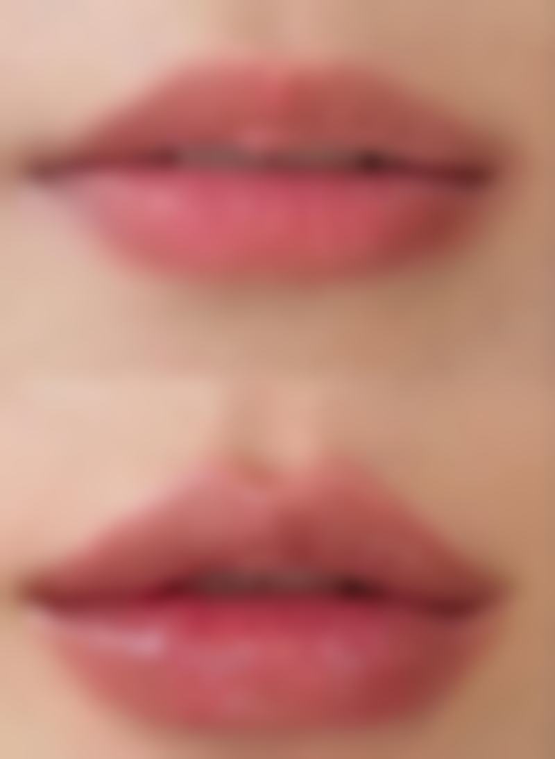 哪种除皱方法效果好？揭秘 3 种热门医美除皱法，让你轻松告别皱纹，重拾年轻肌肤！ 