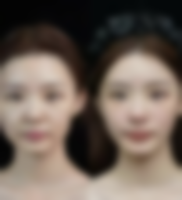 台州纳恩妮亚医疗美容医院参考价格表：