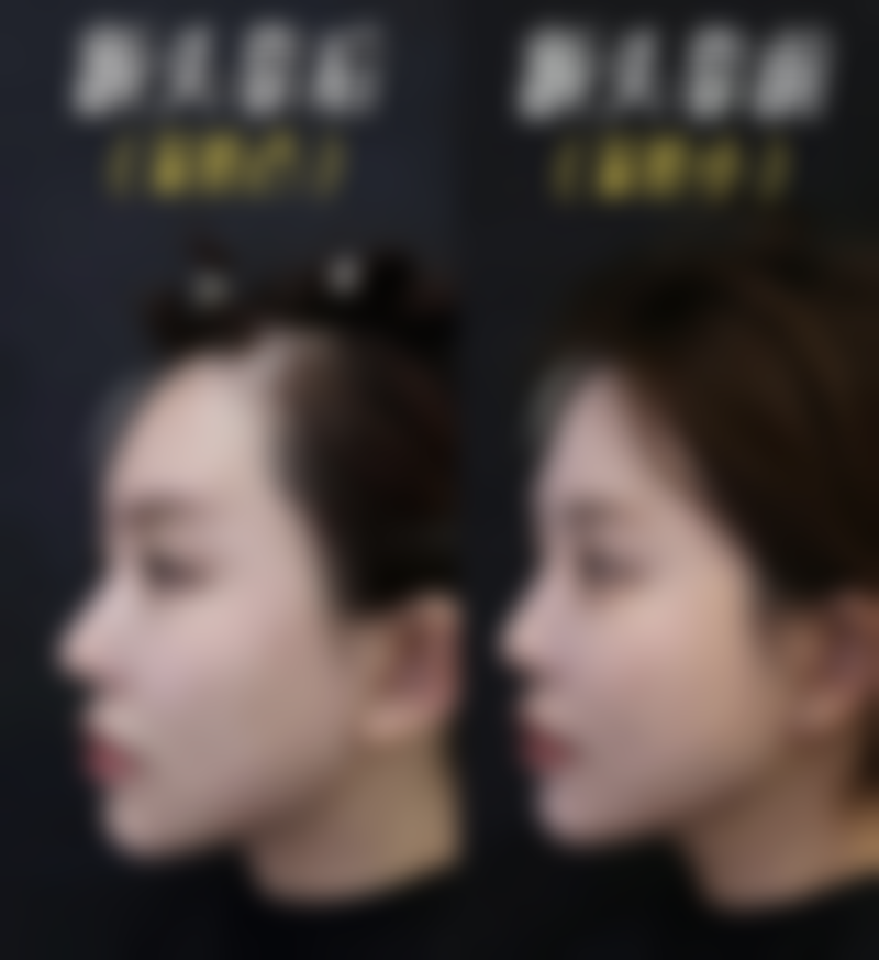 降低风险的注意事项