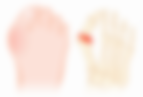 唇部有疤痕怎样化妆