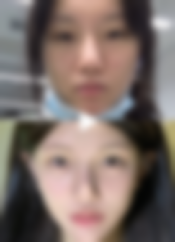 【朱京玉医生擅长项目】