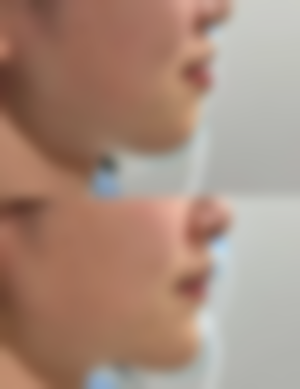 【玉林市红十字会医院整形科特色项目：】