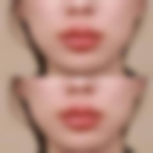 【泉州韩美医疗美容门诊部核心优势：】