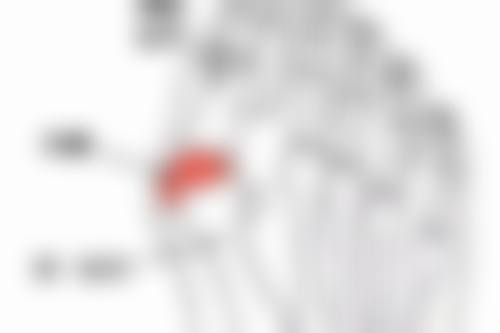 打完瘦脸针8天了感觉脸还是肿的