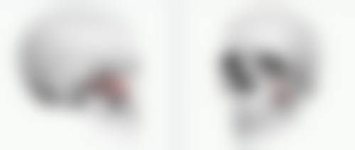 丰太阳穴可能存在的风险