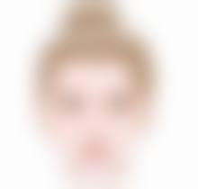 脸部嘴角下垂影响美观吗