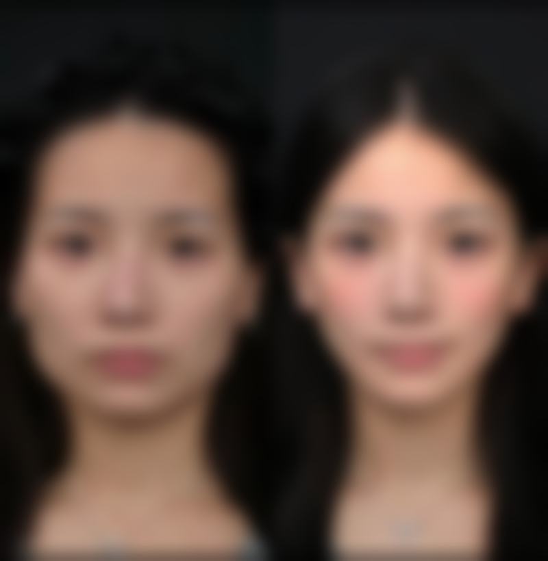 【鹰潭美嘉医疗美容医院地址：】