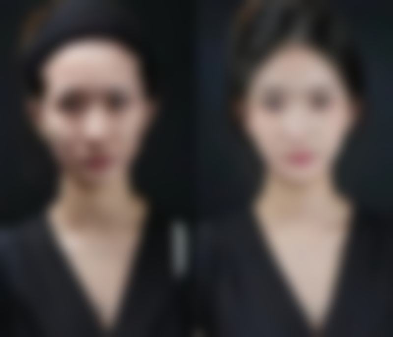 【南阳仟仟美整形医院怎么预约挂号?】