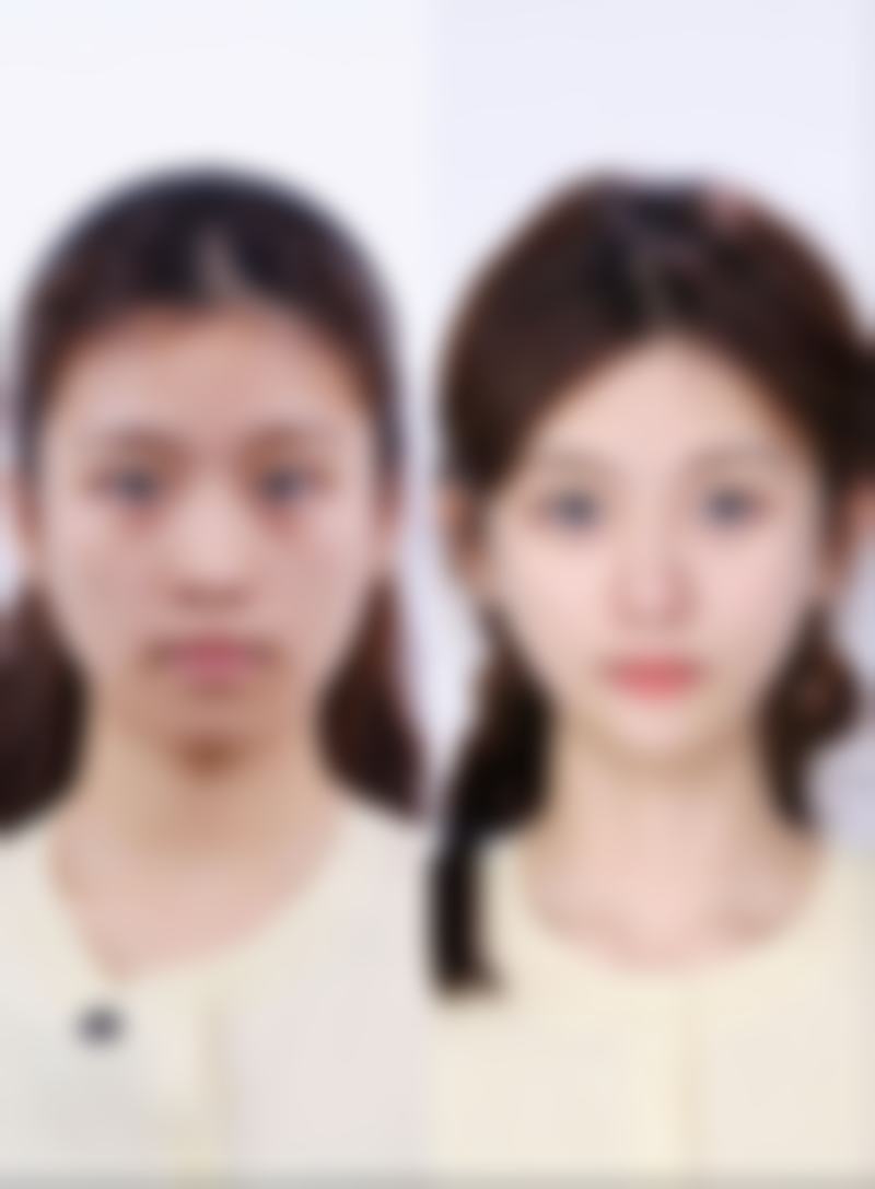 【鹰潭美嘉医疗美容医院特色项目：】