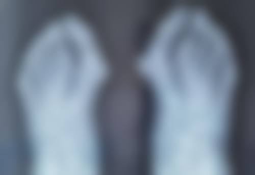 打瘦脸针要多久才能怀孕生孩子