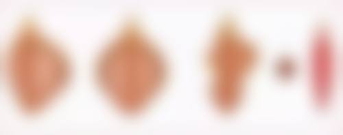 瘦脸针什么牌子的较好？揭秘2024热门3大品牌优势，助你轻松拥有精致小脸！ 