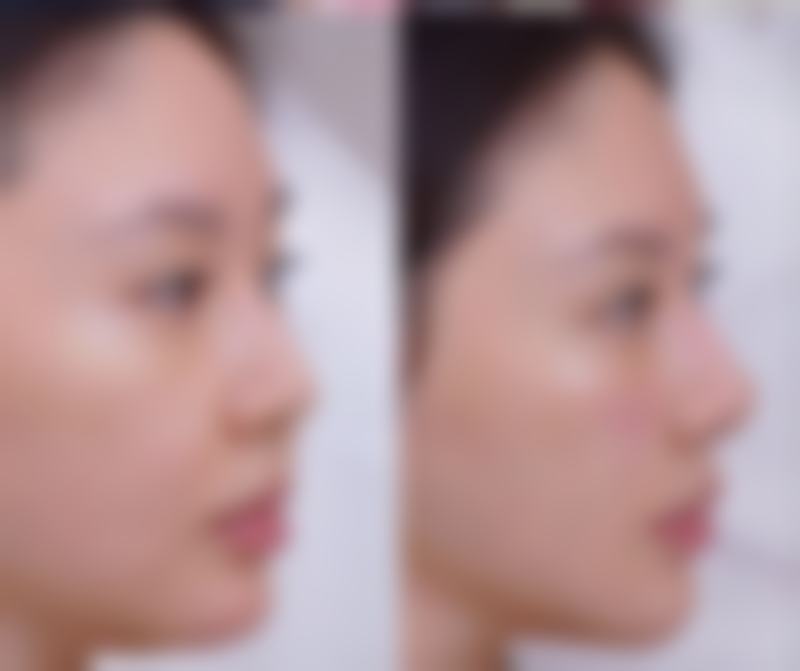 饮食与生活习惯对产后紧致的影响