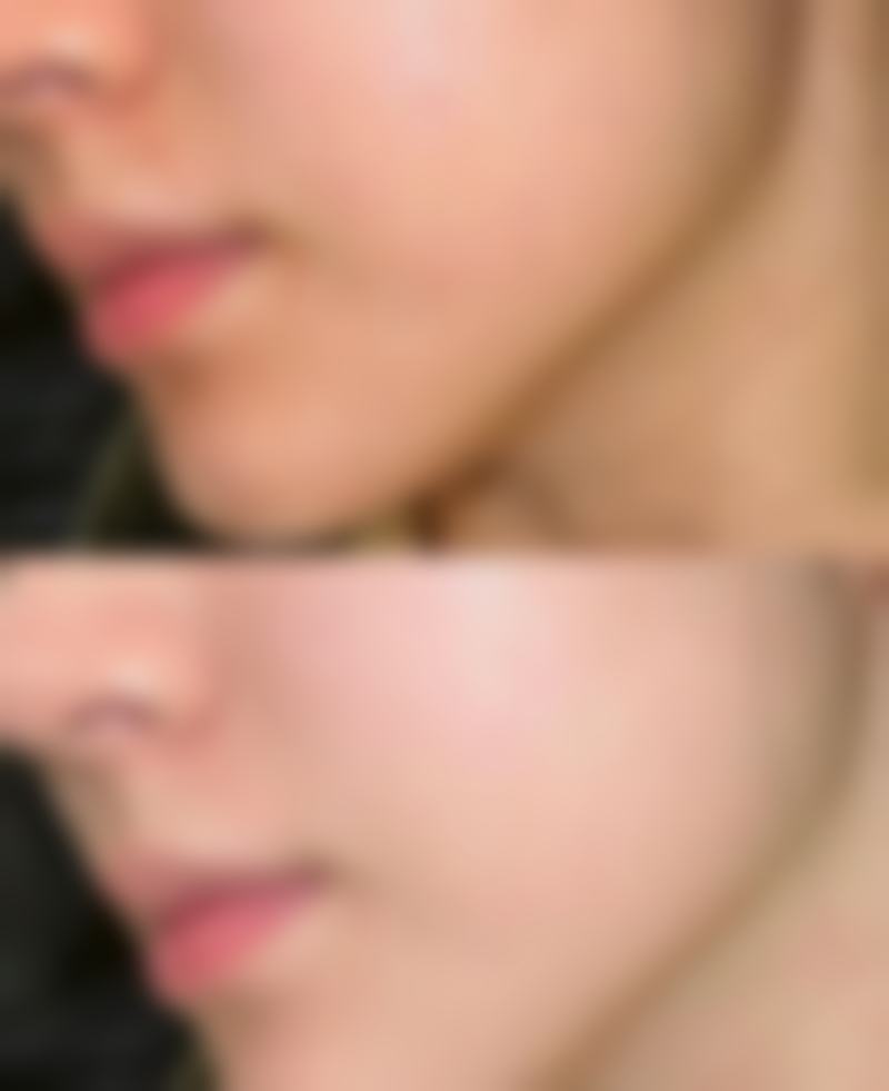 【张铭强医生擅长项目】