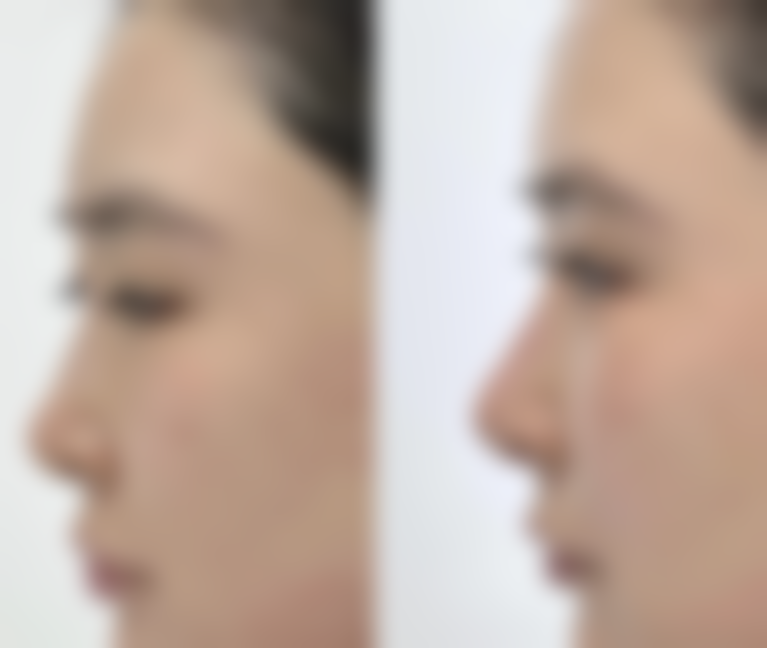 【安康青美医疗美容怎么预约挂号?】