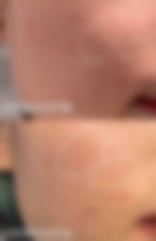 种植头发能生长吗