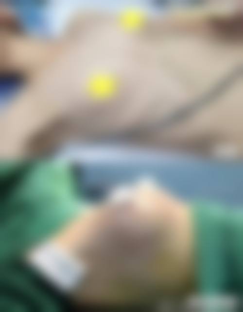 门诊部的特色项目可不少，主要包括医学抗衰、医学美肤、微整美容等。医学抗衰项目能够帮助顾客延缓衰老的脚步，让肌肤保持年轻状态；医学美肤项目可以针对各种肌肤问题，如色斑、痘痘、暗沉等，提供专精的解决方案；微整美容项目则能通过微创的方式，实现面部轮廓的改善和五官的精细化调整，满足不同顾客的个性化需求。