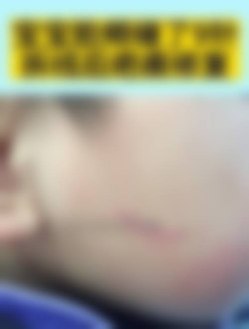 【淄博春之樱整形医院怎么预约挂号?】