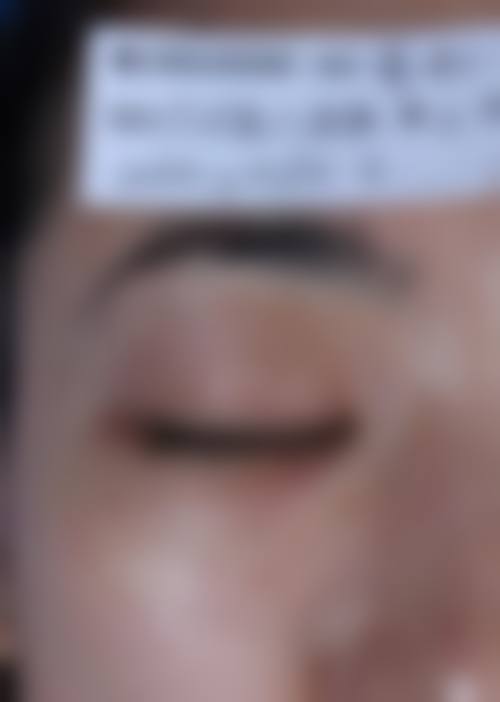 【吴万强医生擅长项目】