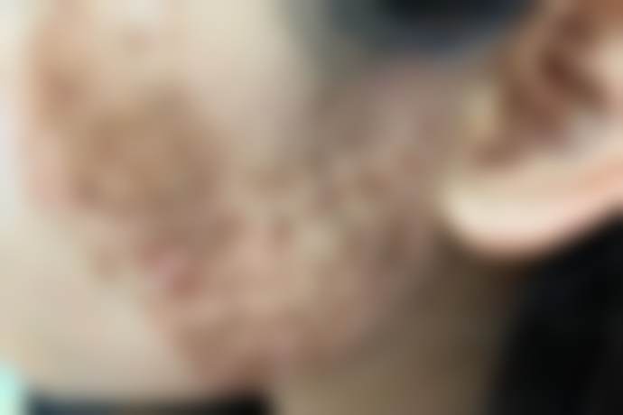 【王锦文医生怎么预约挂号？】