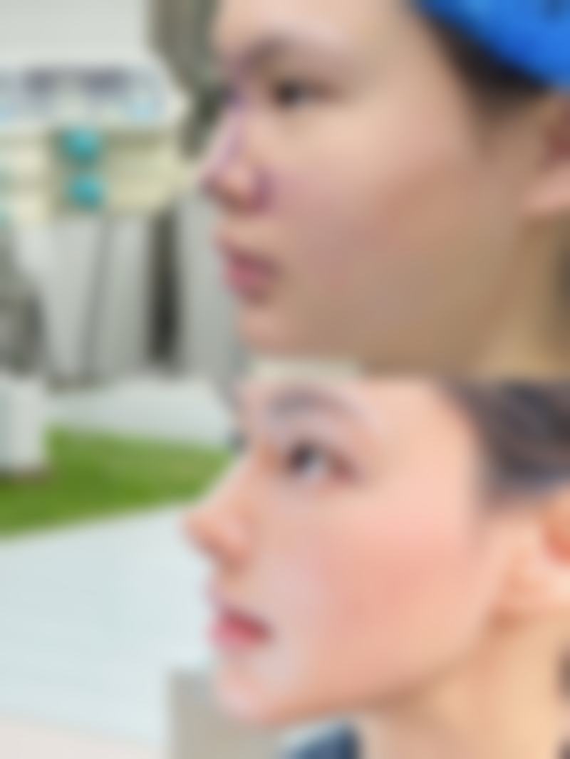 【淄博春之樱整形医院特色项目：】