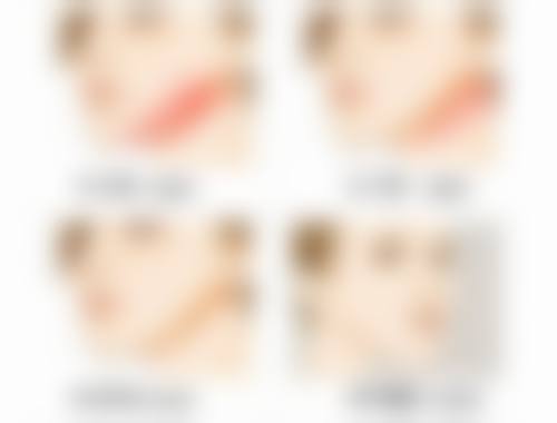 不知道怀孕打了瘦脸针宝宝生下来了