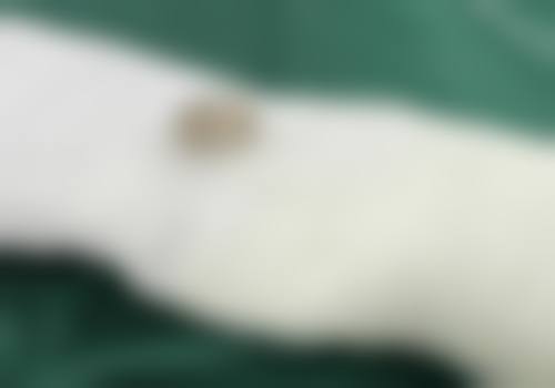 1. “我之前脸上有特别多痘疤，一直特别困扰。来到武汉奇佶医疗美容门诊部，找谢海龙医生做了皮肤美容项目。医生特别专精，根据我的情况制定了详细的治疗方案。经过一段时间的治疗，痘疤明显改善了，皮肤也变得光滑了特别多。这里的服务也良好，工作人员都特别热情，让人感觉特别舒服。”