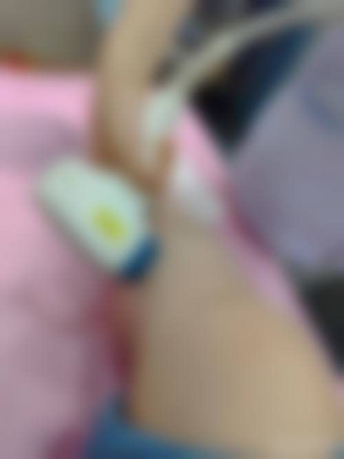 【高天增医生口碑怎么样？】