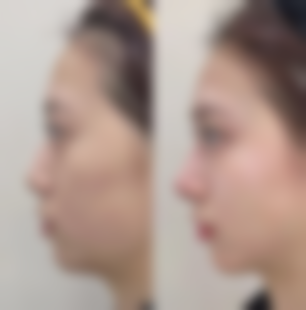 【上海复旦大学附属华东医院整形美容科特色项目：】