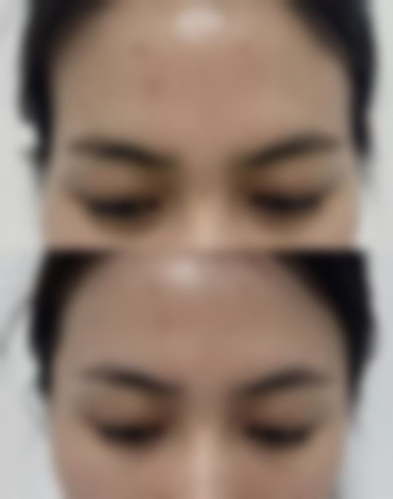 嘴有点歪该挂什么科