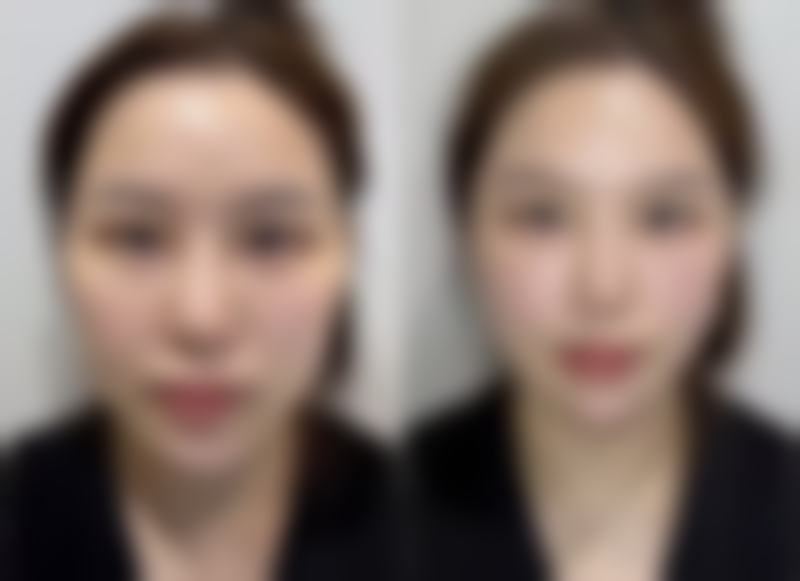 【保定市清苑区虞美人美容医院诊疗设备：】