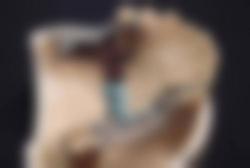 如何让瘦脸针成效更好