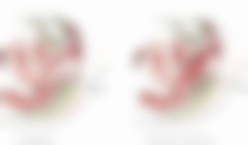 瘦脸针打完肿了怎么回事