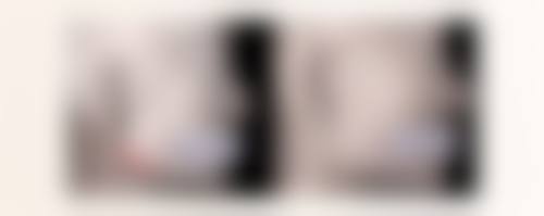 四、扎除皱针好吗