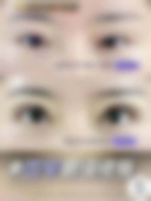 【北京瀛美医疗美容医院参考价格表：】