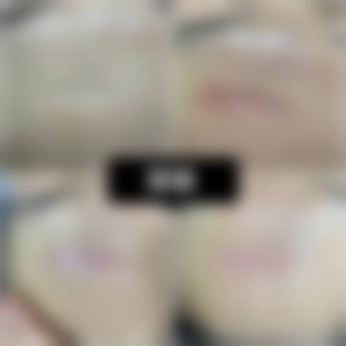 【香河县马艳整形医院怎么预约挂号?】