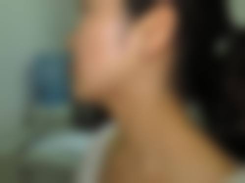 【洛阳喵拾颜整形医院特色项目：】