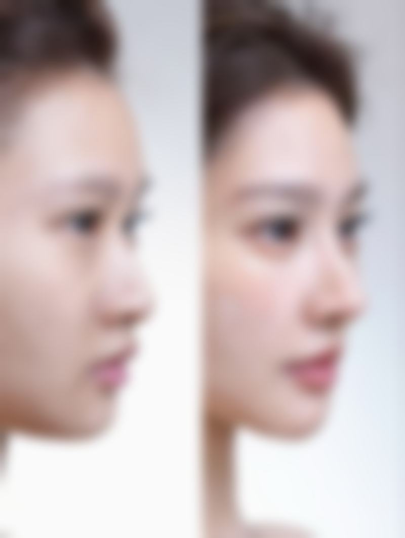 【ISTAR整形外科医院怎么预约挂号?】