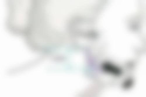 打完瘦脸多久有成效