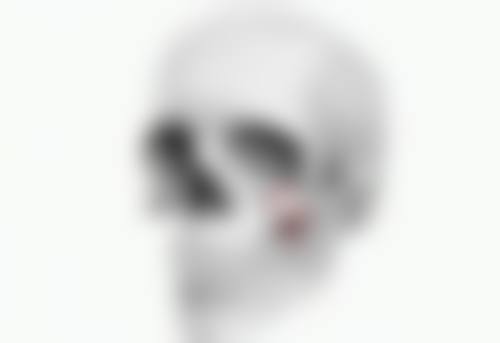 种植的头发脱落期会全部掉光吗