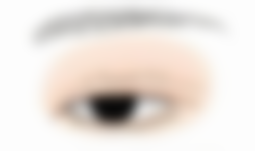 种植头发脱发期是什么情况