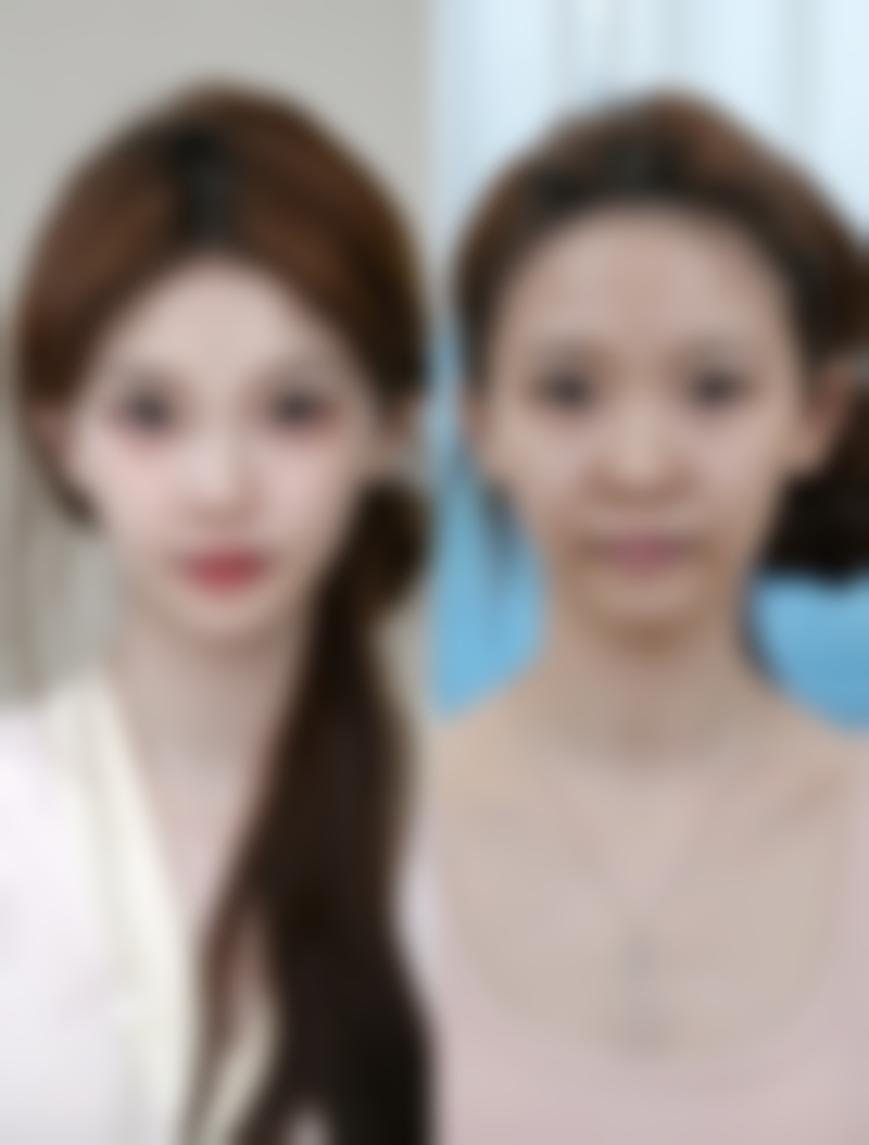 如何判断适合自己的疤痕植发方案