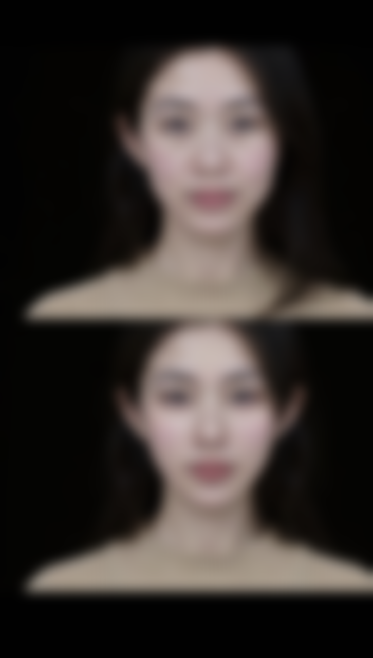 种植的头发脱落后会立马长出来吗