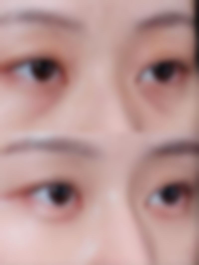 【重庆铜雀台整形医院特色项目：】