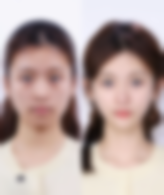 美白针输液输的是什么药