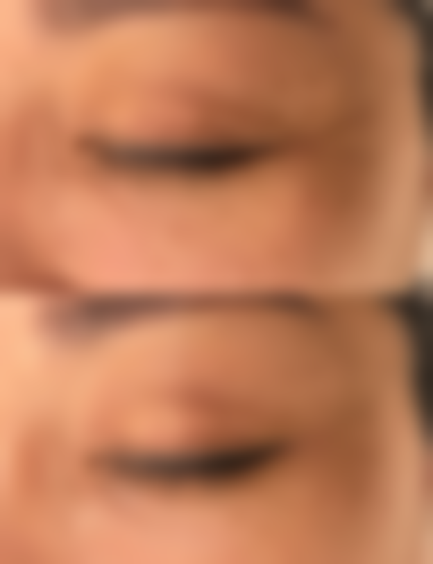 【鸡西市人民医院烧伤整形科患者口碑评价：】