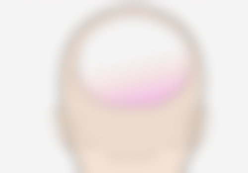 怀孕了不知道打了瘦脸针有影响吗